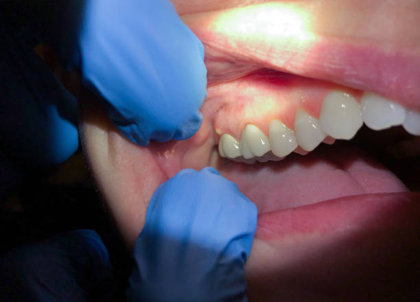 Best Orthodontic Emergency Dentist in West Wyomissing, PA
