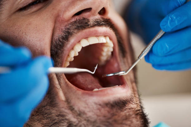 Best Weekend Emergency Dentist in West Wyomissing, PA